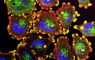 Characterising the proteogenomic landscape of lung squamous cell carcinoma